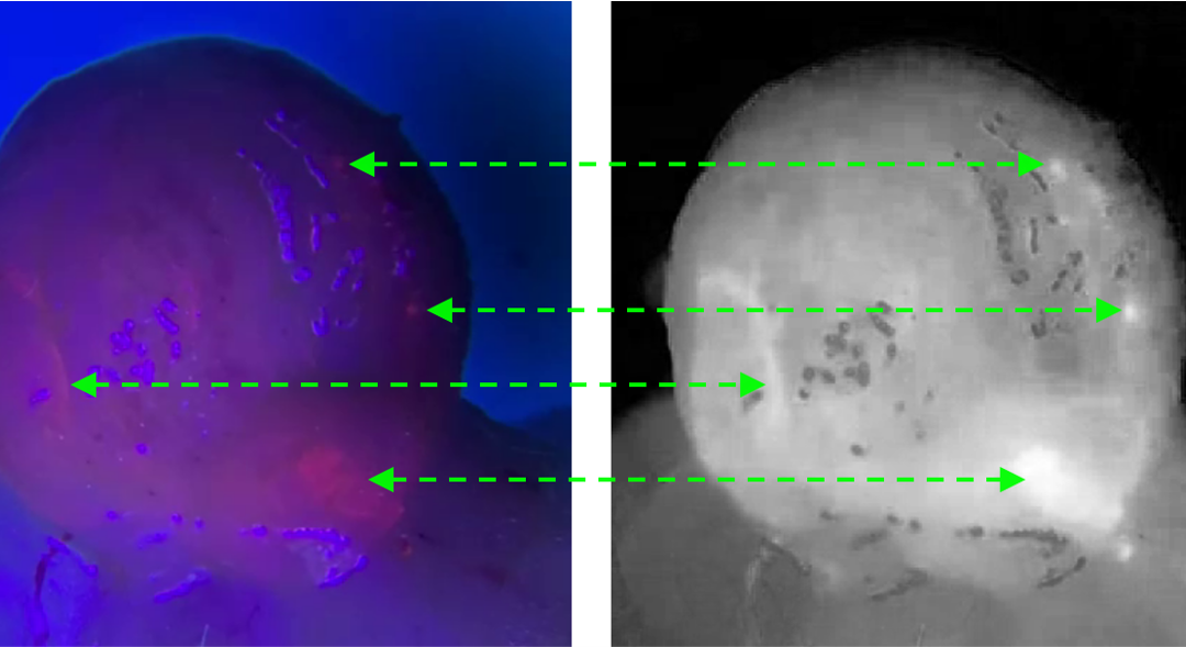 in vivo tumor detection