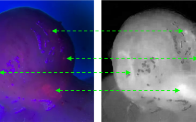 in vivo tumor detection